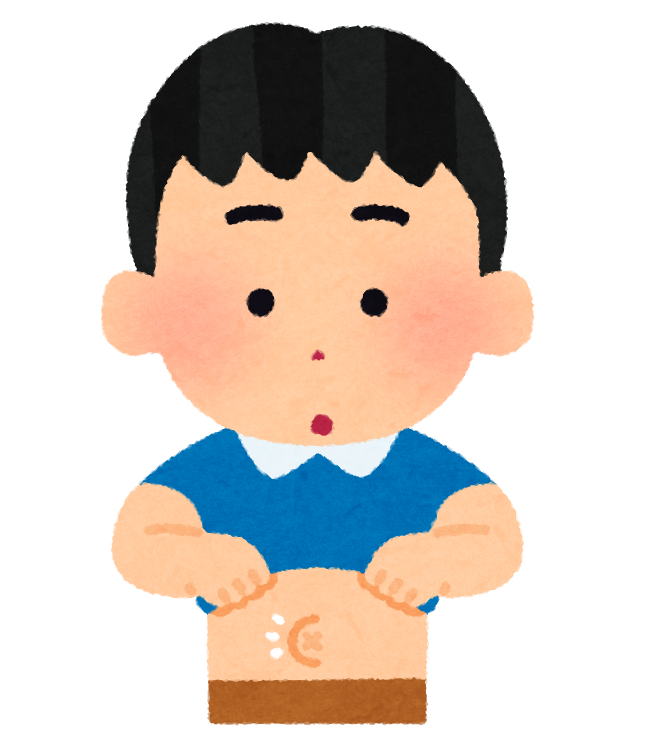 臍ヘルニア（でべそ）とは
